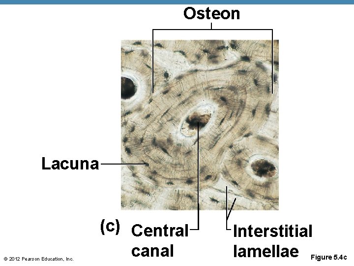 Osteon Lacuna © 2012 Pearson Education, Inc. (c) Central canal Interstitial lamellae Figure 5.