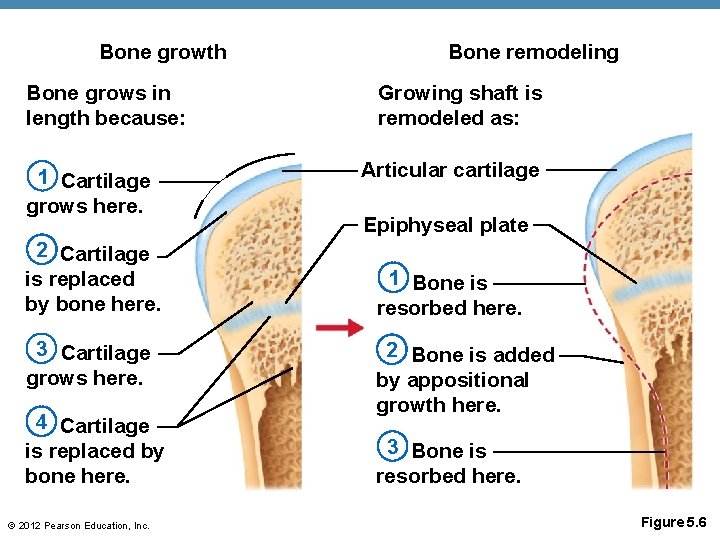 Bone growth Bone grows in length because: 1 Cartilage grows here. 2 Cartilage is