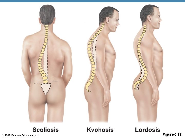 © 2012 Pearson Education, Inc. Figure 5. 18 