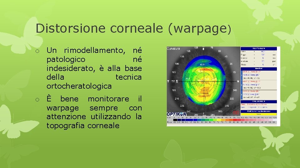 Distorsione corneale (warpage) o Un rimodellamento, né patologico né indesiderato, è alla base della