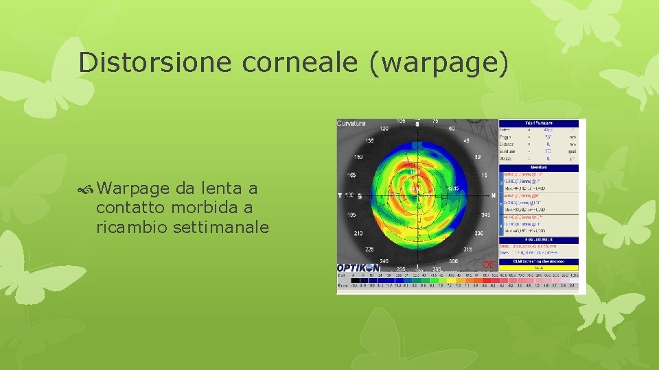 Distorsione corneale (warpage) Warpage da lenta a contatto morbida a ricambio settimanale 