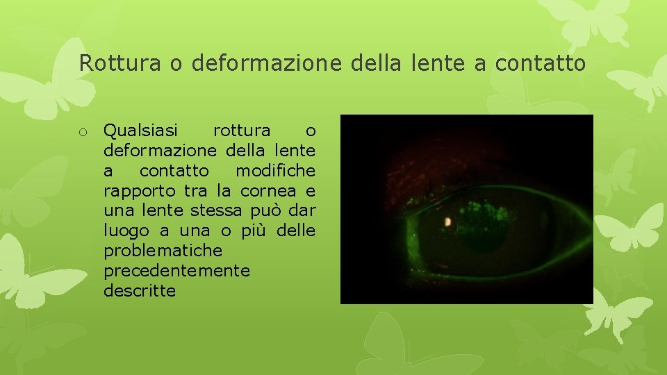 Rottura o deformazione della lente a contatto o Qualsiasi rottura o deformazione della lente
