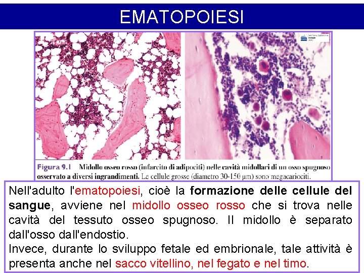 EMATOPOIESI Nell'adulto l'ematopoiesi, cioè la formazione delle cellule del sangue, avviene nel midollo osseo