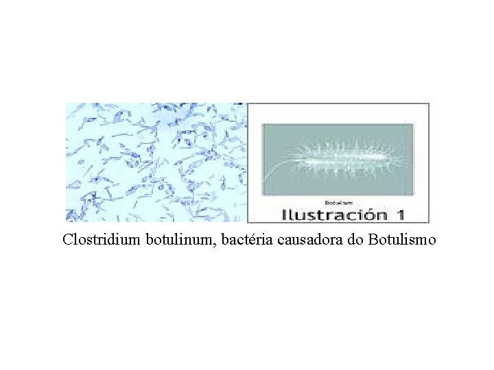 Clostridium botulinum, bactéria causadora do Botulismo 