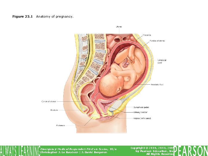 Figure 23. 1 Anatomy of pregnancy. Emergency Medical Responder: First on Scene, 10/e Christopher