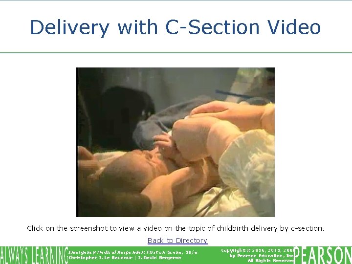 Delivery with C-Section Video Click on the screenshot to view a video on the