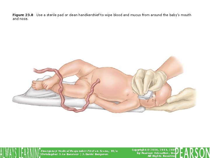 Figure 23. 8 and nose. Use a sterile pad or clean handkerchief to wipe