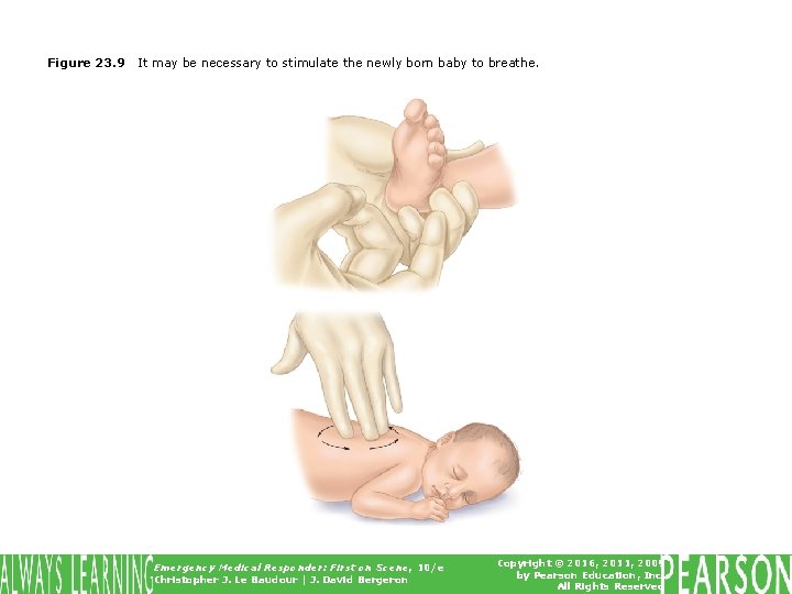 Figure 23. 9 It may be necessary to stimulate the newly born baby to