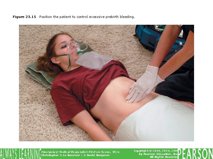 Figure 23. 15 Position the patient to control excessive prebirth bleeding. Emergency Medical Responder: