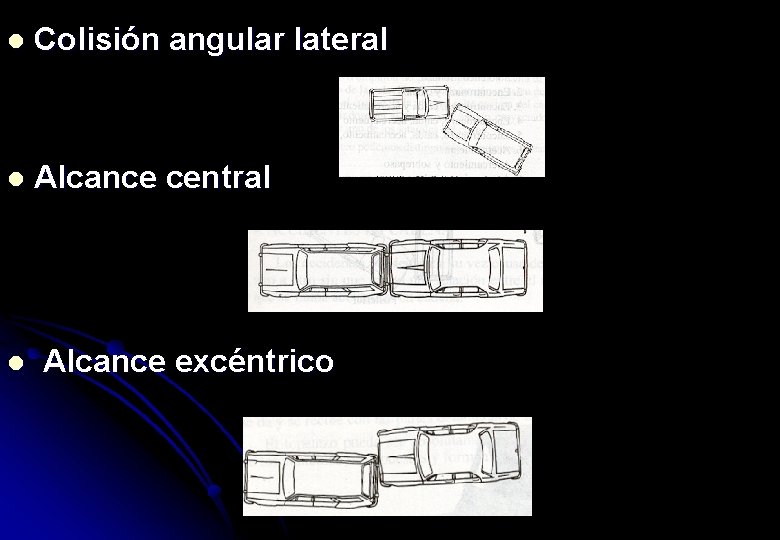 l Colisión angular lateral l Alcance central l Alcance excéntrico 