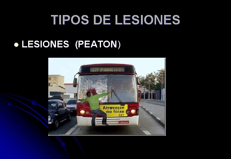 TIPOS DE LESIONES l LESIONES (PEATON) 