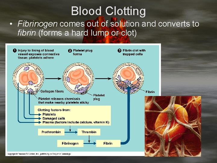 Blood Clotting • Fibrinogen comes out of solution and converts to fibrin (forms a