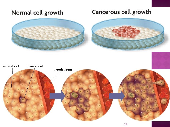 normal cell cancer cell bloodstream 29 
