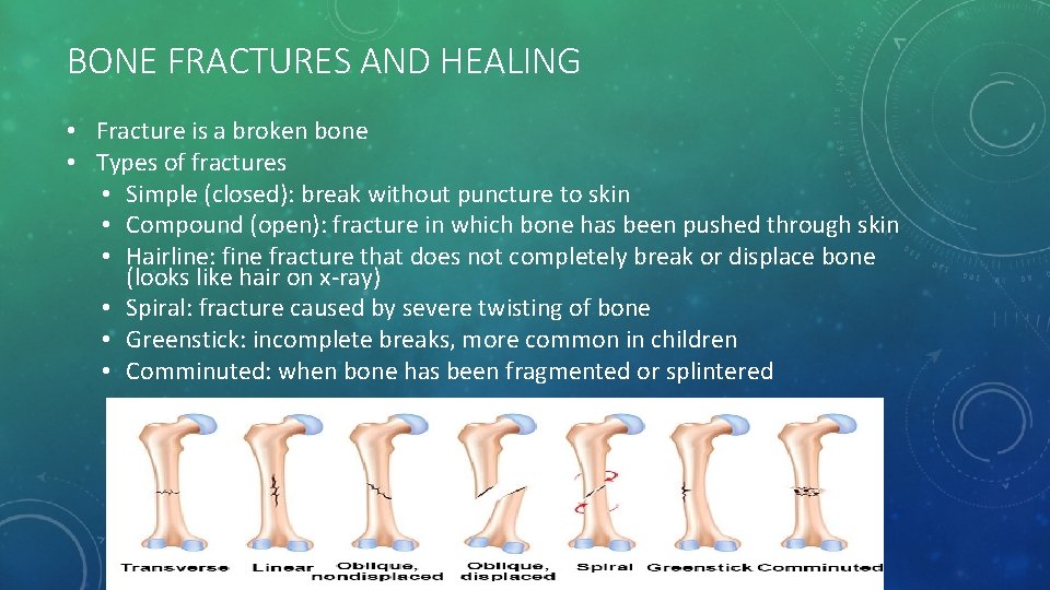 BONE FRACTURES AND HEALING • Fracture is a broken bone • Types of fractures