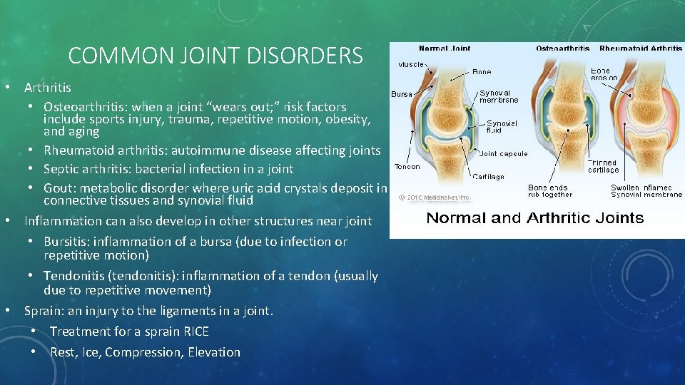 COMMON JOINT DISORDERS • Arthritis • Osteoarthritis: when a joint “wears out; ” risk
