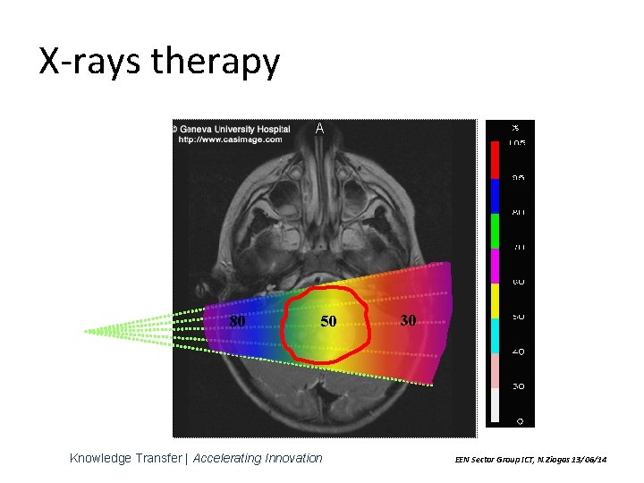 X-rays therapy 80 50 Knowledge Transfer | Accelerating Innovation 30 EEN Sector Group ICT,