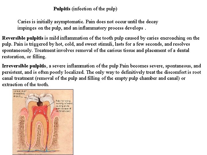 Pulpitis (infection of the pulp) Caries is initially asymptomatic. Pain does not occur until