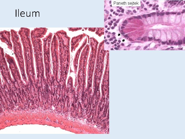 Paneth sejtek Ileum 
