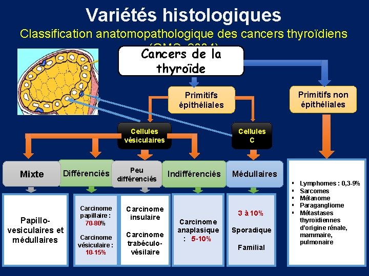 Variétés histologiques Classification anatomopathologique des cancers thyroïdiens (OMS, 2004) Cancers de la thyroïde Primitifs