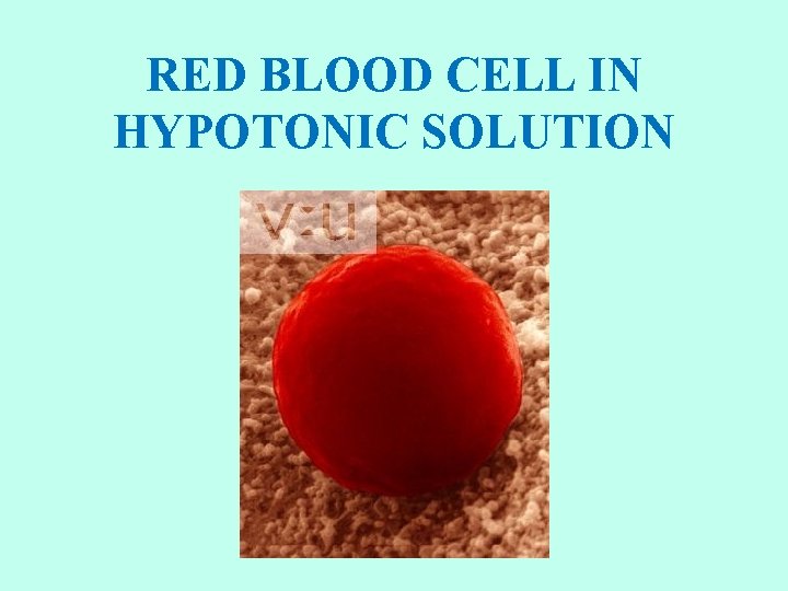 RED BLOOD CELL IN HYPOTONIC SOLUTION 