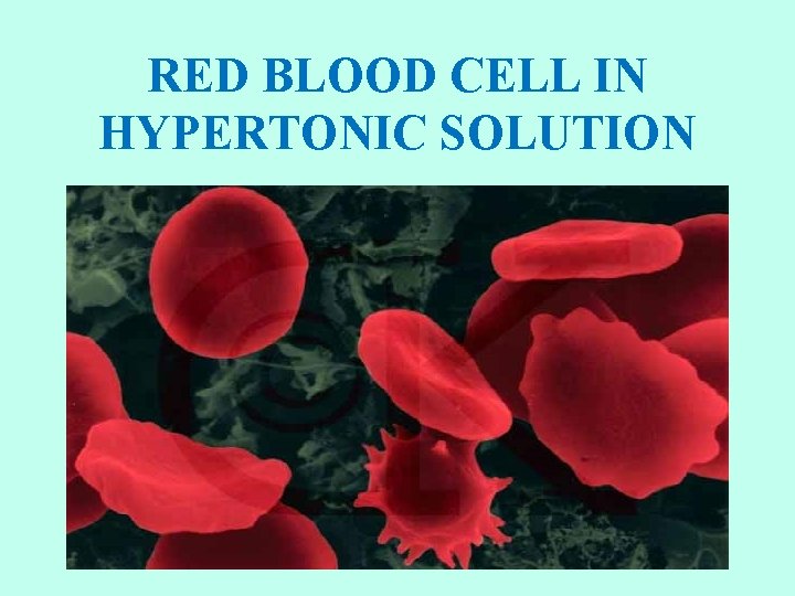 RED BLOOD CELL IN HYPERTONIC SOLUTION 