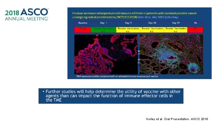 Gulley et al. Oral Presentation. ASCO 2018 