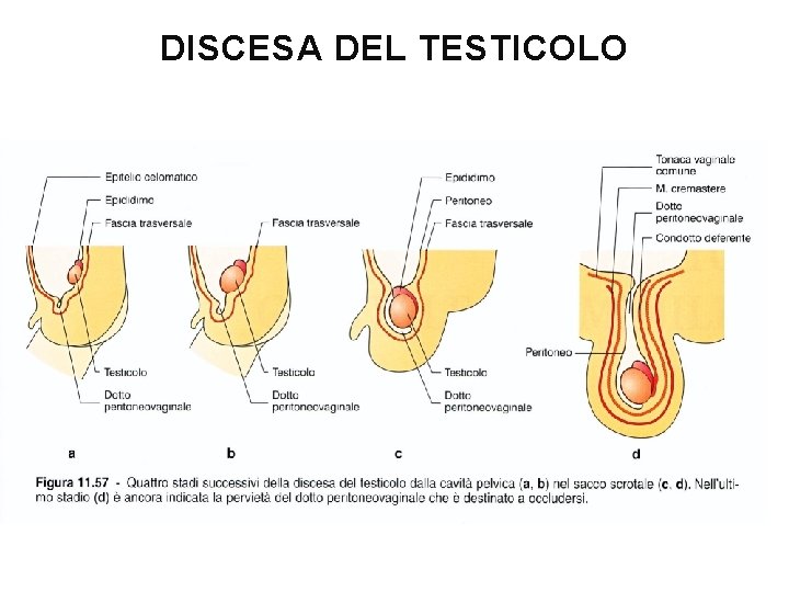 DISCESA DEL TESTICOLO 