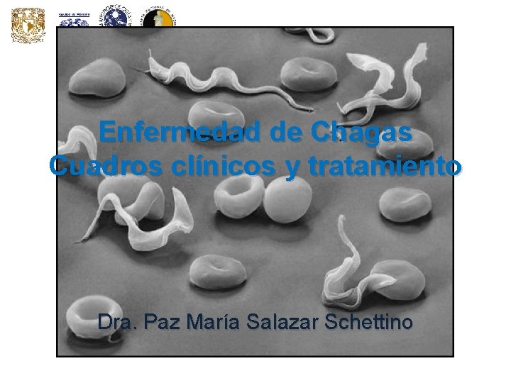 Enfermedad de Chagas Cuadros clínicos y tratamiento Dra. Paz María Salazar Schettino 