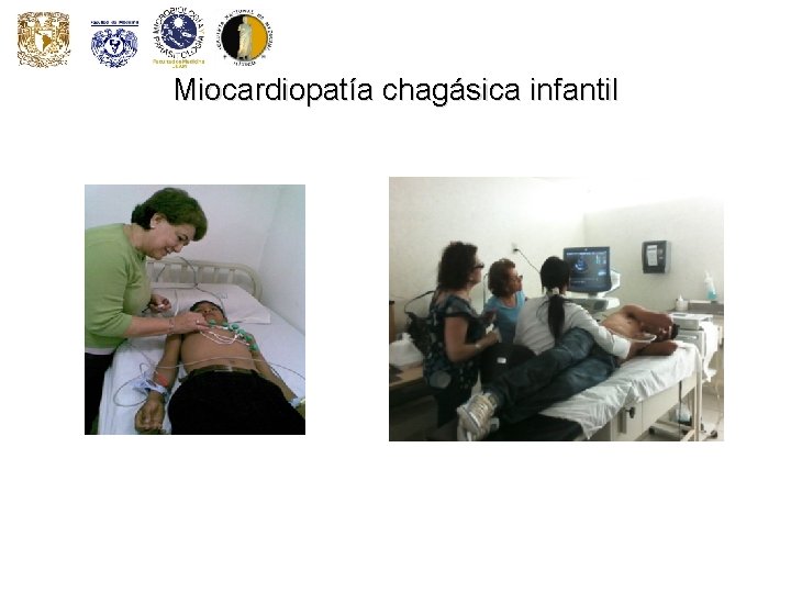 Miocardiopatía chagásica infantil 