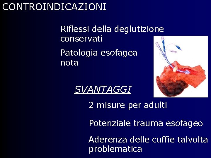 CONTROINDICAZIONI Riflessi della deglutizione conservati Patologia esofagea nota SVANTAGGI 2 misure per adulti Potenziale