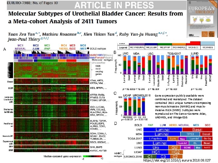 Gene expression publicly available were combined and reanalyzed. The dataset contained 2411 unique tumors