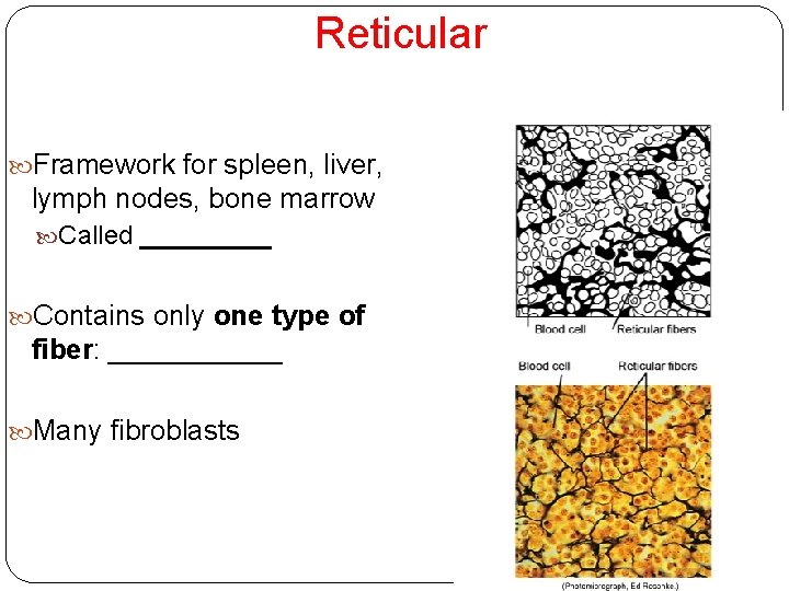 Reticular Framework for spleen, liver, lymph nodes, bone marrow Called _____ Contains only one