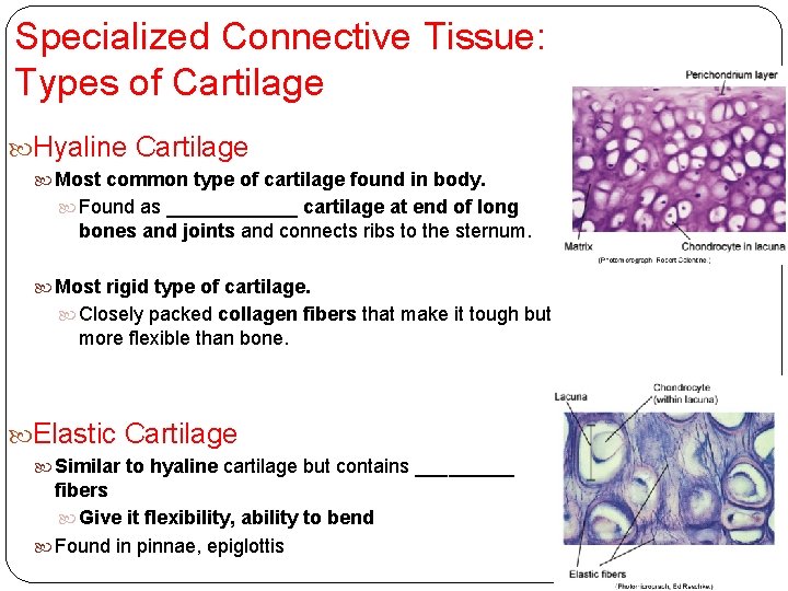 Specialized Connective Tissue: Types of Cartilage Hyaline Cartilage Most common type of cartilage found