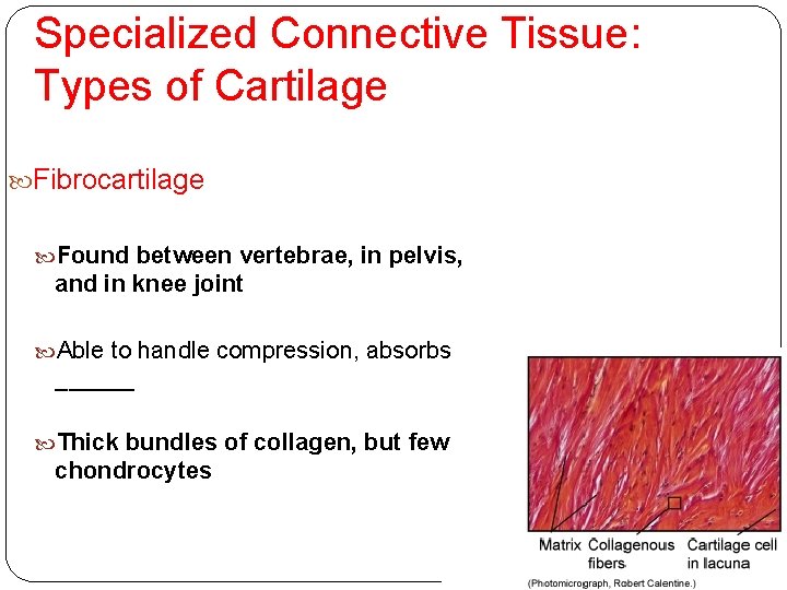 Specialized Connective Tissue: Types of Cartilage Fibrocartilage Found between vertebrae, in pelvis, and in