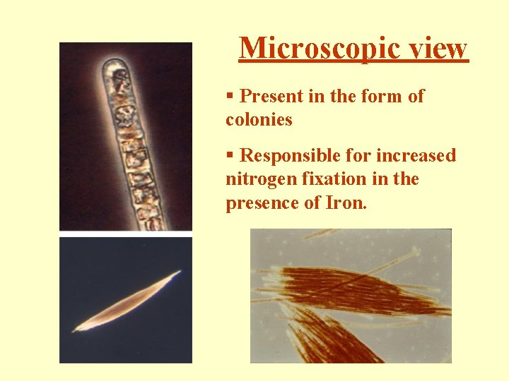 Microscopic view § Present in the form of colonies § Responsible for increased nitrogen