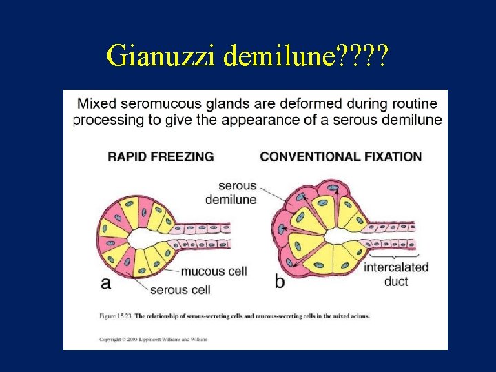 Gianuzzi demilune? ? 