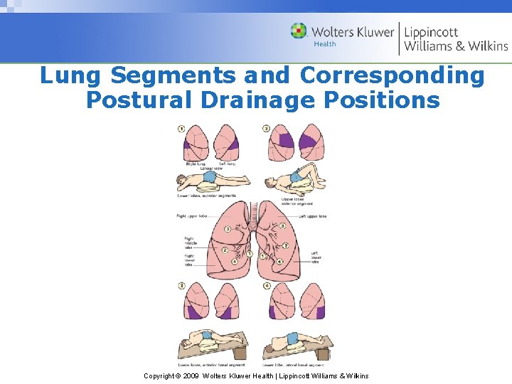 Lung Segments and Corresponding Postural Drainage Positions Copyright © 2009 Wolters Kluwer Health |