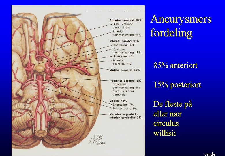 Aneurysmers fordeling 85% anteriort 15% posteriort De fleste på eller nær circulus willisii 