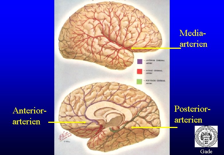 Mediaarterien Anteriorarterien Posteriorarterien Gade 