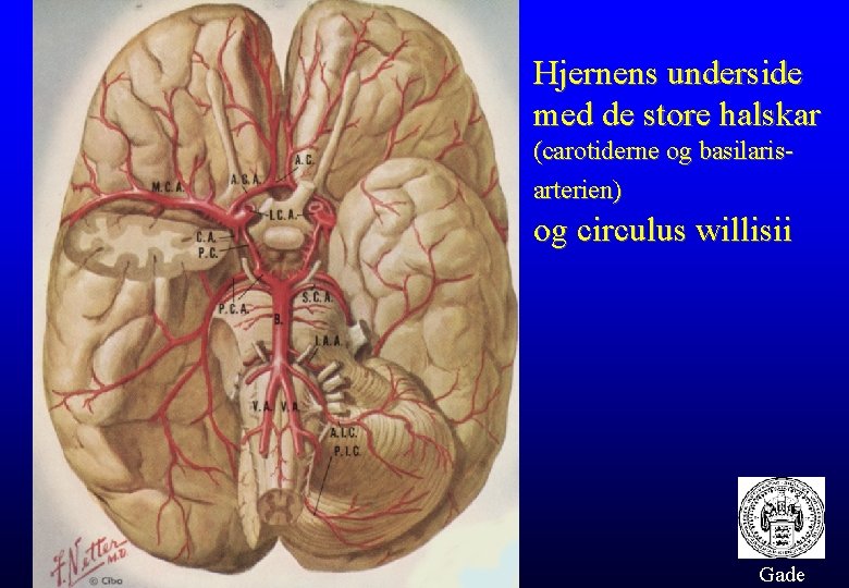 Hjernens underside med de store halskar (carotiderne og basilarisarterien) og circulus willisii Gade 