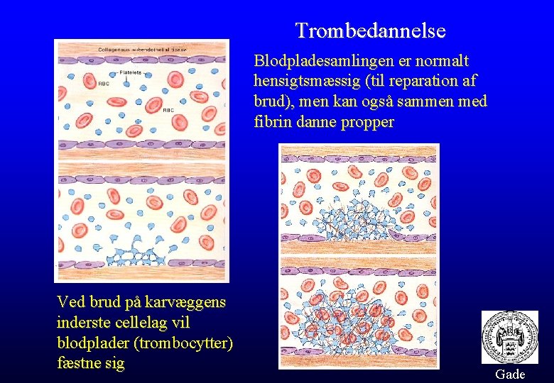 Trombedannelse Blodpladesamlingen er normalt hensigtsmæssig (til reparation af brud), men kan også sammen med