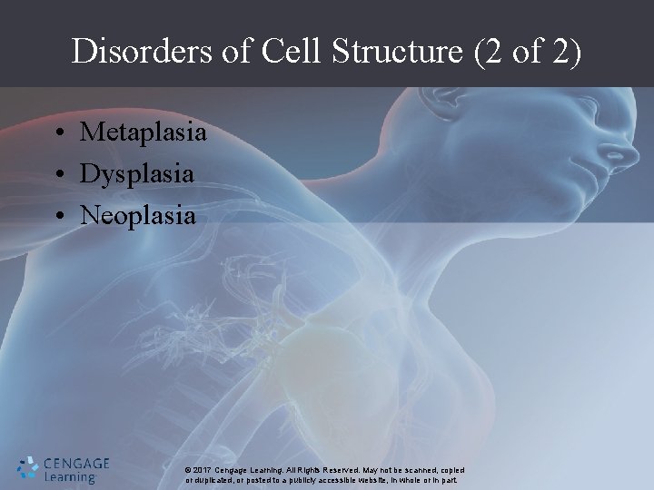 Disorders of Cell Structure (2 of 2) • Metaplasia • Dysplasia • Neoplasia ©