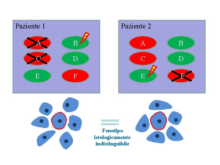 Paziente 1 Paziente 2 A B C D E F Fenotipo istologicamente indistinguibile 