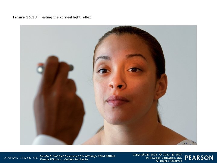 Figure 15. 13 Testing the corneal light reflex. Health & Physical Assessment in Nursing,