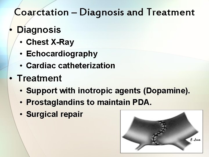 Coarctation – Diagnosis and Treatment • Diagnosis • Chest X-Ray • Echocardiography • Cardiac