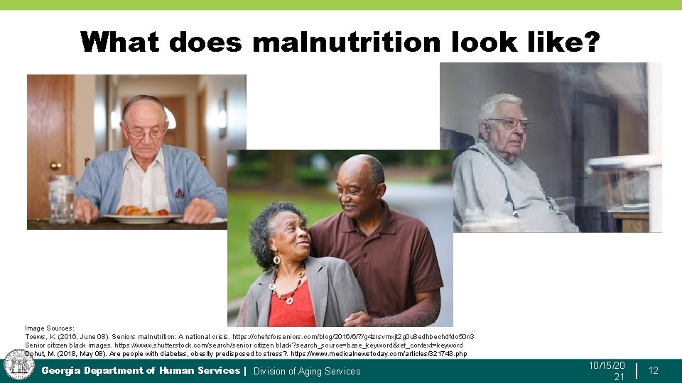 What does malnutrition look like? Image Sources: Toews, K. (2016, June 08). Seniors malnutrition: