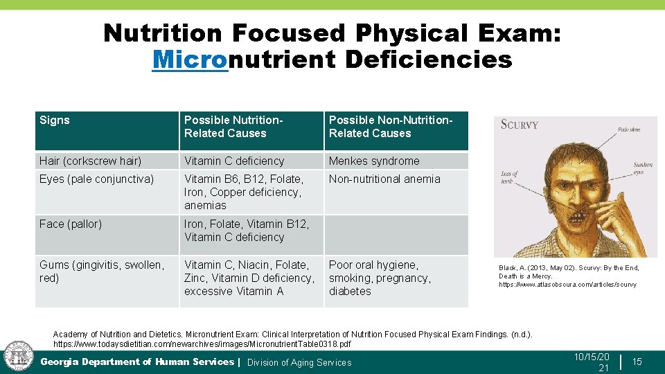 Nutrition Focused Physical Exam: Micronutrient Deficiencies Signs Possible Nutrition. Related Causes Possible Non-Nutrition. Related