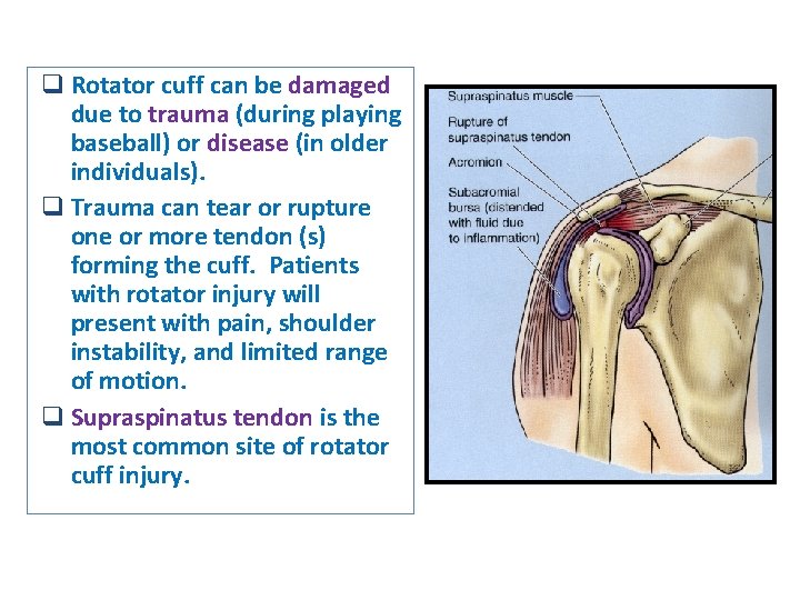q Rotator cuff can be damaged due to trauma (during playing baseball) or disease