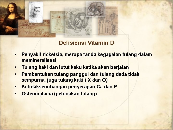 Defisiensi Vitamin D • • • Penyakit ricketsia, merupa tanda kegagalan tulang dalam memineralisasi