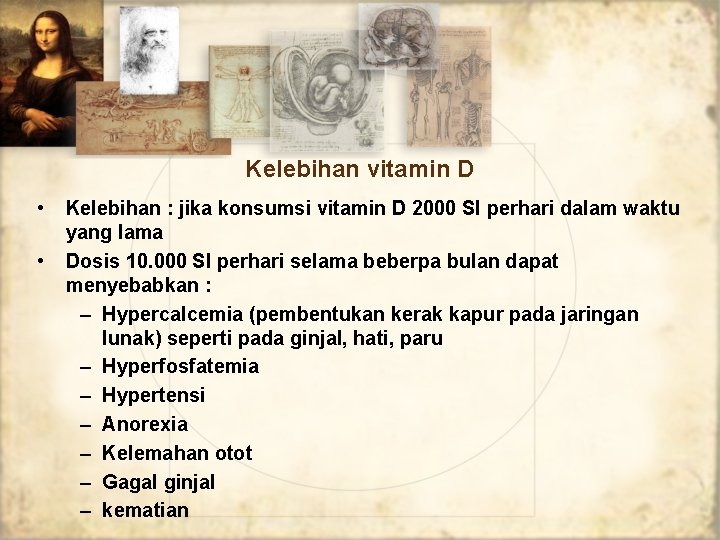 Kelebihan vitamin D • • Kelebihan : jika konsumsi vitamin D 2000 SI perhari